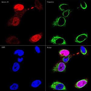 Confocal imaging of HeLa cells using Anti-Vimentin Antibody [ARC0086] (A305554), at a dilution of 1:100 (green), and Anti-Aurora B Antibody, at a dilution of 1:800 (red). DAPI was used for nuclear staining (Blue). Objective: 60x