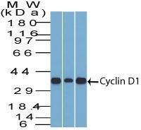 Western blot analysis of (Lane 1) C2C12 cell line lysate, (Lane 2) HepG2 cell line lysate, and (Lane 3) NIH3T3 cell line lysate using Anti-Cyclin D1 Antibody [SPM587]