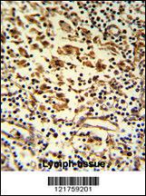 Anti-HA-1 Rabbit Polyclonal Antibody (FITC (Fluorescein))