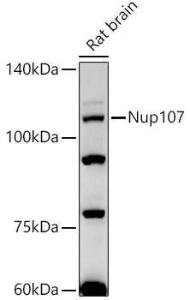 Western blot analysis of extracts of Rat brain, using Anti-Nup107 Antibody [ARC2942] (A306525) at 1:500 dilution. The secondary antibody was Goat Anti-Rabbit IgG H&L Antibody (HRP) at 1:10,000 dilution.