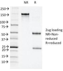 SDS-PAGE analysis of Anti-CD11c Antibody [ITGAX/1243] under non-reduced and reduced conditions; showing intact IgG and intact heavy and light chains, respectively. SDS-PAGE analysis confirms the integrity and purity of the antibody.