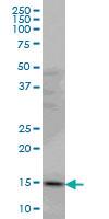 Anti-PDE6D Mouse Monoclonal Antibody [clone: 5C7]