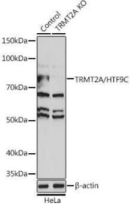 Western blot analysis of extracts from normal (control) and TRMT2A/HTF9C knockout (KO) HeLa cells, using Anti-HTF9C / TRMT2A Antibody (A306527) at 1:500 dilution