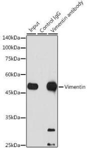 Immunoprecipitation analysis of 300 µg extracts of Jurkat cells using 3 µg of Anti-Vimentin Antibody [ARC0086] (A305554). This Western blot was performed on the immunoprecipitate using Anti-Vimentin Antibody [ARC0086] (A305554) at a dilution of 1:1000