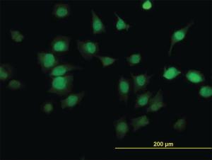 Anti-PDE6D Mouse Monoclonal Antibody [clone: 5C7]