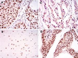 Anti-PSIP1 Mouse Monoclonal Antibody [clone: 6E4]