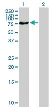 Anti-ZNF169 Mouse Polyclonal Antibody