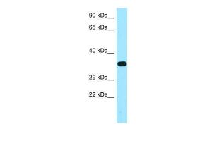 Anti-FOLR2 Rabbit Polyclonal Antibody