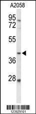 Anti-FUT3 Rabbit Polyclonal Antibody (FITC (Fluorescein Isothiocyanate))