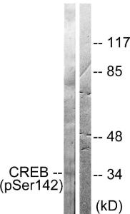 Western blot analysis of lysates from HeLa cells treated with PMA 125ng/ml 30' using Anti-CREB (phospho Ser142) Antibody. The right hand lane represents a negative control, where the antibody is blocked by the immunising peptide