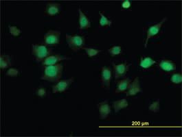 Anti-PDE6D Mouse Monoclonal Antibody [clone: 5C7]