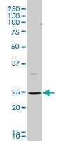 Anti-BCAP29 Mouse Monoclonal Antibody [clone: 4B10]