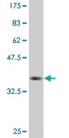 Anti-C10ORF2 Mouse Monoclonal Antibody [clone: 1C5]