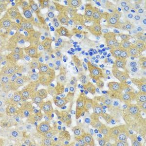 Immunohistochemistry analysis of paraffin-embedded mouse liver using Anti-MEK4/MKK4 Antibody (A306529) at a dilution of 1:100 (40x lens) Perform microwave antigen retrieval with 10 mM PBS buffer pH 72 before commencing with IHC staining protocol