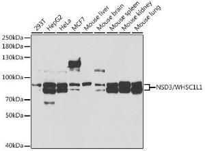 Western blot analysis of extracts of various cell lines, using Anti-NSD3 Antibody (A11848) at 1:1000 dilution. The secondary Antibody was Goat Anti-Rabbit IgG H&L Antibody (HRP) at 1:10000 dilution. Lysates/proteins were present at 25 µg per lane