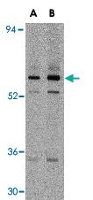 Anti-CFLAR Rabbit Polyclonal Antibody