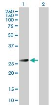 Anti-BCAP31 Rabbit Polyclonal Antibody