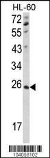 Anti-Nucleoside Diphosphate Kinase D Rabbit Polyclonal Antibody (HRP (Horseradish Peroxidase))