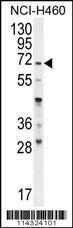 Anti-FUT4 Rabbit Polyclonal Antibody