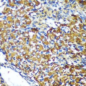 Immunohistochemistry analysis of paraffin-embedded rat ovary using Anti-MEK4/MKK4 Antibody (A306529) at a dilution of 1:100 (40x lens) Perform microwave antigen retrieval with 10 mM PBS buffer pH 72 before commencing with IHC staining protocol