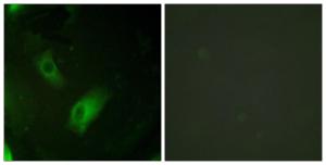 Immunofluorescence analysis of HeLa cells using Anti-IREB1 Antibody. The right hand panel represents a negative control, where the Antibody was pre-incubated with the immunising peptide