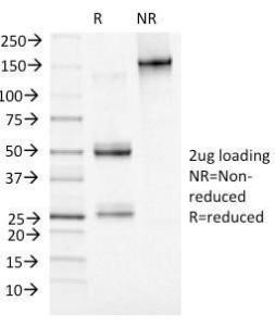 SDS-PAGE analysis of Anti-Adipophilin Antibody [ADFP/1493] under non-reduced and reduced conditions; showing intact IgG and intact heavy and light chains, respectively. SDS-PAGE analysis confirms the integrity and purity of the Antibody