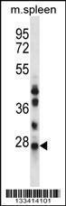 Anti-NQO2 Rabbit Polyclonal Antibody (FITC (Fluorescein Isothiocyanate))