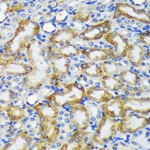 Immunohistochemistry analysis of paraffin-embedded mouse kidney using Anti-MEK4/MKK4 Antibody (A306529) at a dilution of 1:100 (40x lens) Perform microwave antigen retrieval with 10 mM PBS buffer pH 72 before commencing with IHC staining protocol