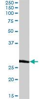 Anti-BCAP31 Rabbit Polyclonal Antibody