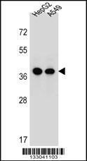 Anti-ERLIN1 Rabbit Polyclonal Antibody (AP (Alkaline Phosphatase))