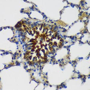 Immunohistochemistry analysis of paraffin-embedded rat lung using Anti-MEK4/MKK4 Antibody (A306529) at a dilution of 1:100 (40x lens) Perform microwave antigen retrieval with 10 mM PBS buffer pH 72 before commencing with IHC staining protocol