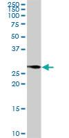 Anti-BCAP31 Rabbit Polyclonal Antibody