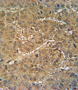 Anti-VKORC1 Rabbit Polyclonal Antibody (PE (Phycoerythrin))