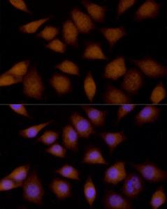 Immunofluorescence analysis of L929 cells using Anti-MEK4/MKK4 Antibody (A306529) at a dilution of 1:100 (40x lens) DAPI was used to stain the cell nuclei (blue)