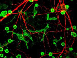 Anti-Alpha-Internexin antibody