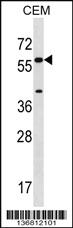 Anti-CYP21A2 Rabbit Polyclonal Antibody