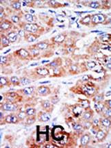 Anti-Nucleoside Diphosphate Kinase D Rabbit Polyclonal Antibody (Biotin)