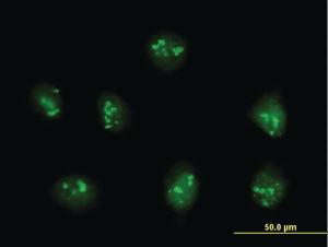 Anti-PDE9A Mouse Polyclonal Antibody