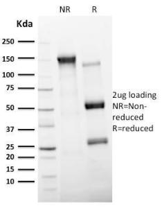 SDS-PAGE analysis of Anti-CD11c Antibody [ITGAX/2507] under non-reduced and reduced conditions; showing intact IgG and intact heavy and light chains, respectively. SDS-PAGE analysis confirms the integrity and purity of the antibody.