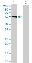 Anti-GPATCH3 Mouse Polyclonal Antibody