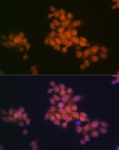 Immunofluorescence analysis of HeLa cells using Anti-WAPL/FOE Antibody [ARC2088] (A307938) at a dilution of 1:100 (40X lens). DAPI was used to stain the cell nuclei (blue)