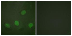 Immunofluorescence analysis of HeLa cells using Anti-CREB (phospho Ser142) Antibody. The right hand panel represents a negative control, where the antibody was pre-incubated with the immunising peptide