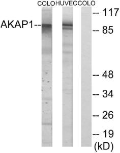 Anti-AKAP1 Rabbit Polyclonal Antibody