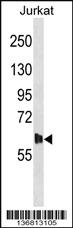 Anti-DMPK Rabbit Polyclonal Antibody