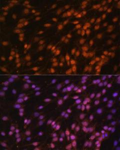 Anti-FUBP1/FBP antibody