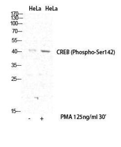 Western blot analysis of various cells using Anti-CREB (phospho Ser142) Antibody