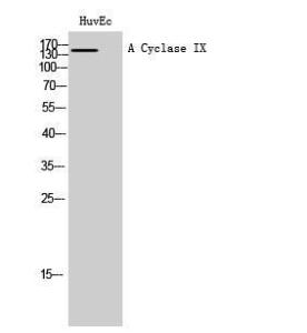 Western blot analysis of HuvEc cells using Anti-ADCY9 Antibody