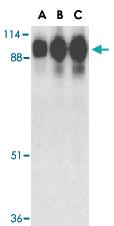 Anti-ACE2 Rabbit Polyclonal Antibody