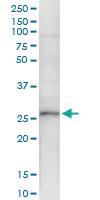 Anti-XRCC3 Polyclonal Antibody Pair