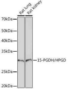 Western blot analysis of extracts of various cell lines, using Anti-15-PGDH Antibody [ARC1280] (A305556) at 1:1000 dilution